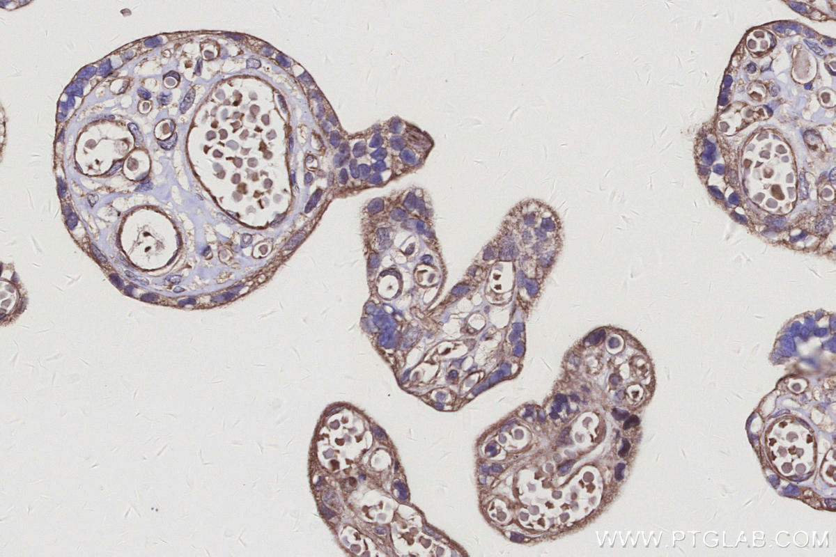 IHC staining of human placenta using 31938-1-AP Immunohistochemistry (IHC) staining of human placenta tissue using ARHGAP23 Polyclonal antibody (31938-1-AP)