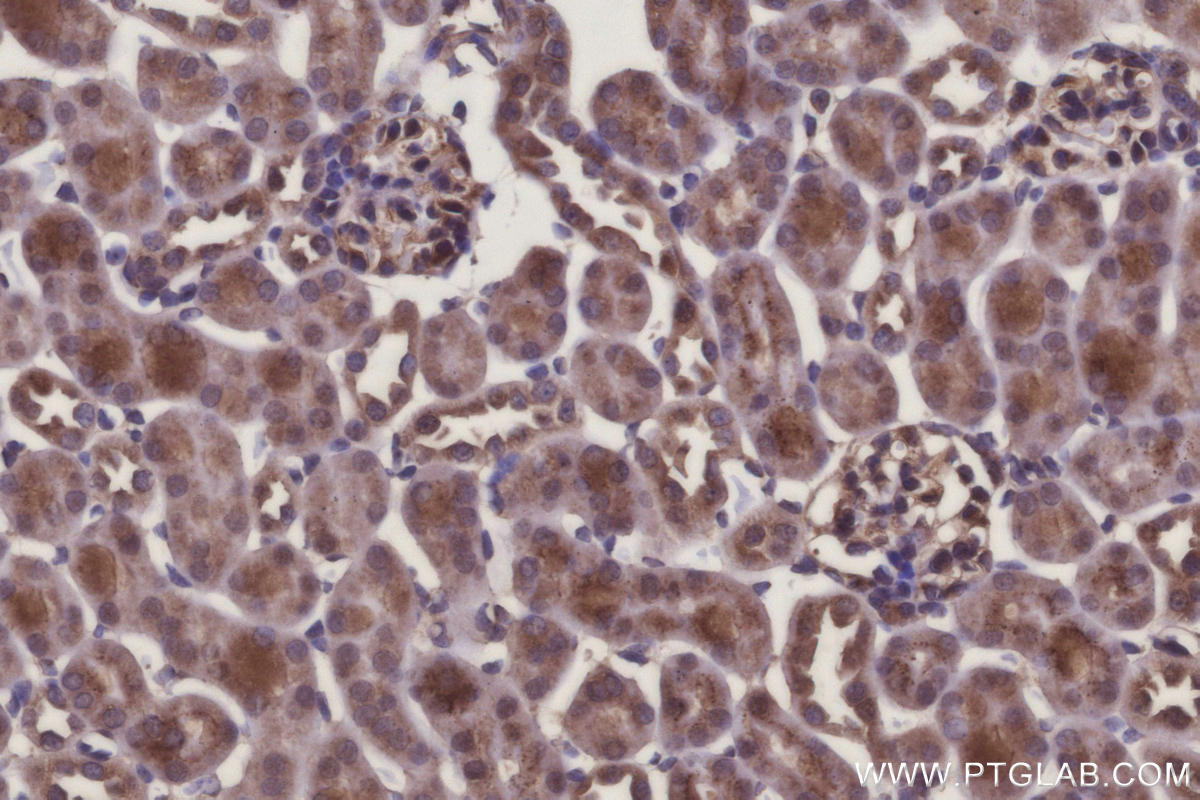 IHC staining of mouse kidney using 31938-1-AP Immunohistochemistry (IHC) staining of mouse kidney tissue using ARHGAP23 Polyclonal antibody (31938-1-AP)