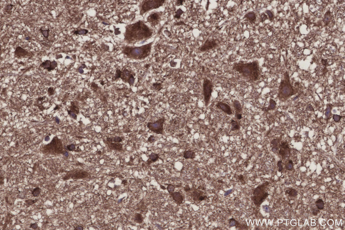 IHC staining of mouse cerebellum using 31938-1-AP Immunohistochemistry (IHC) staining of mouse cerebellum tissue using ARHGAP23 Polyclonal antibody (31938-1-AP)