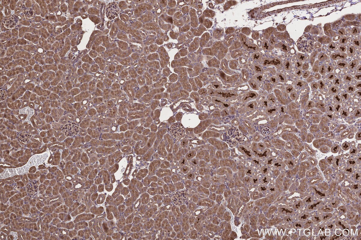 IHC staining of mouse kidney using 18834-1-AP Immunohistochemistry (IHC) staining of mouse kidney tissue using ARHGAP24 Polyclonal antibody (18834-1-AP)