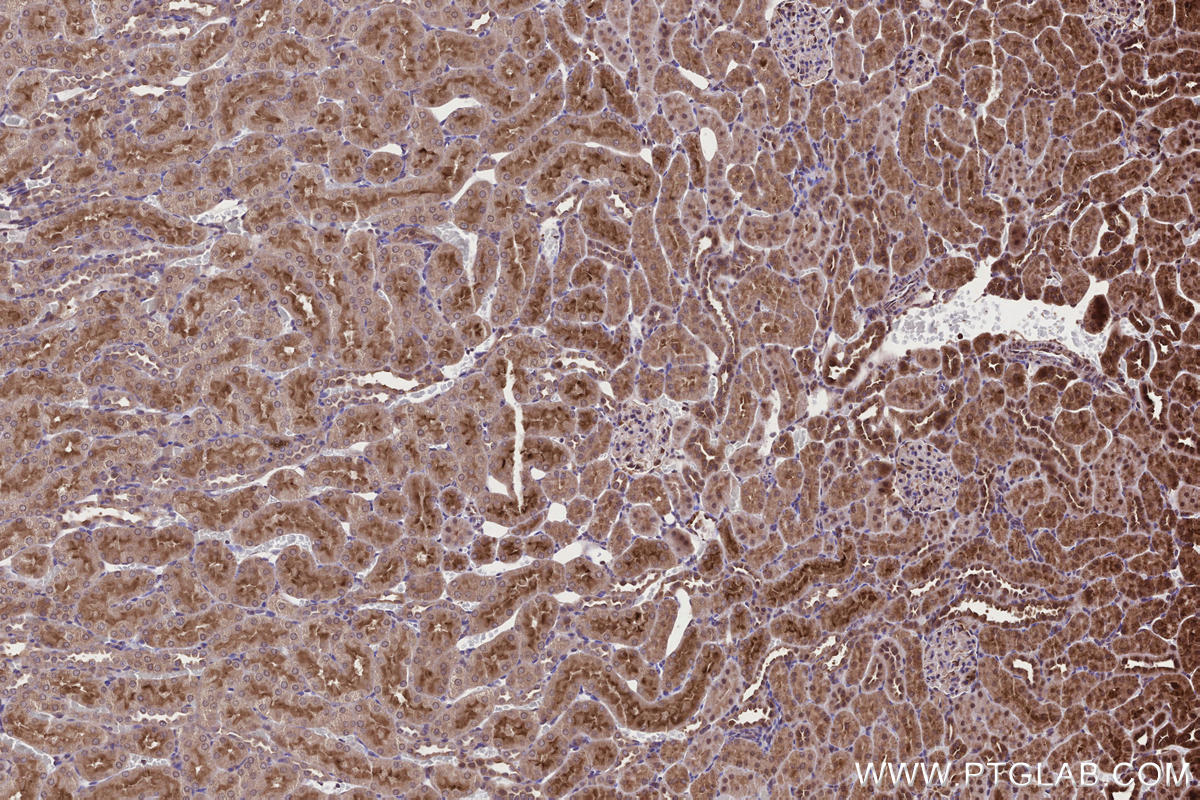 IHC staining of rat kidney using 18834-1-AP Immunohistochemistry (IHC) staining of rat kidney tissue using ARHGAP24 Polyclonal antibody (18834-1-AP)