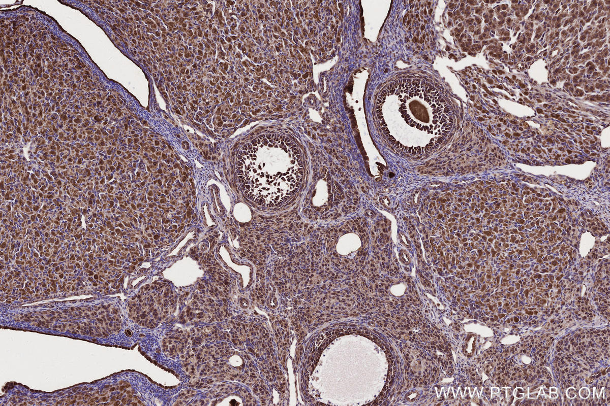 IHC staining of rat ovary using 18834-1-AP Immunohistochemistry (IHC) staining of rat ovary tissue using ARHGAP24 Polyclonal antibody (18834-1-AP)