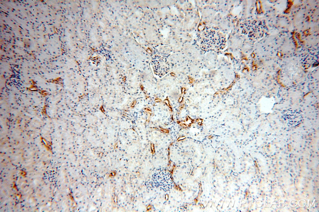 Immunohistochemistry (IHC) staining of human kidney tissue using ARHGAP24 Polyclonal antibody (18834-1-AP)