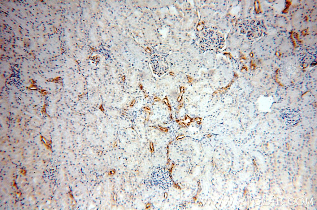 Immunohistochemistry (IHC) staining of human kidney tissue using ARHGAP24 Polyclonal antibody (18834-1-AP)