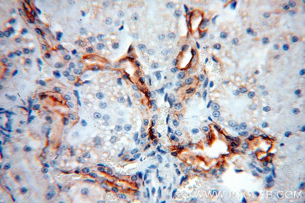 Immunohistochemistry (IHC) staining of human kidney tissue using ARHGAP24 Polyclonal antibody (18834-1-AP)
