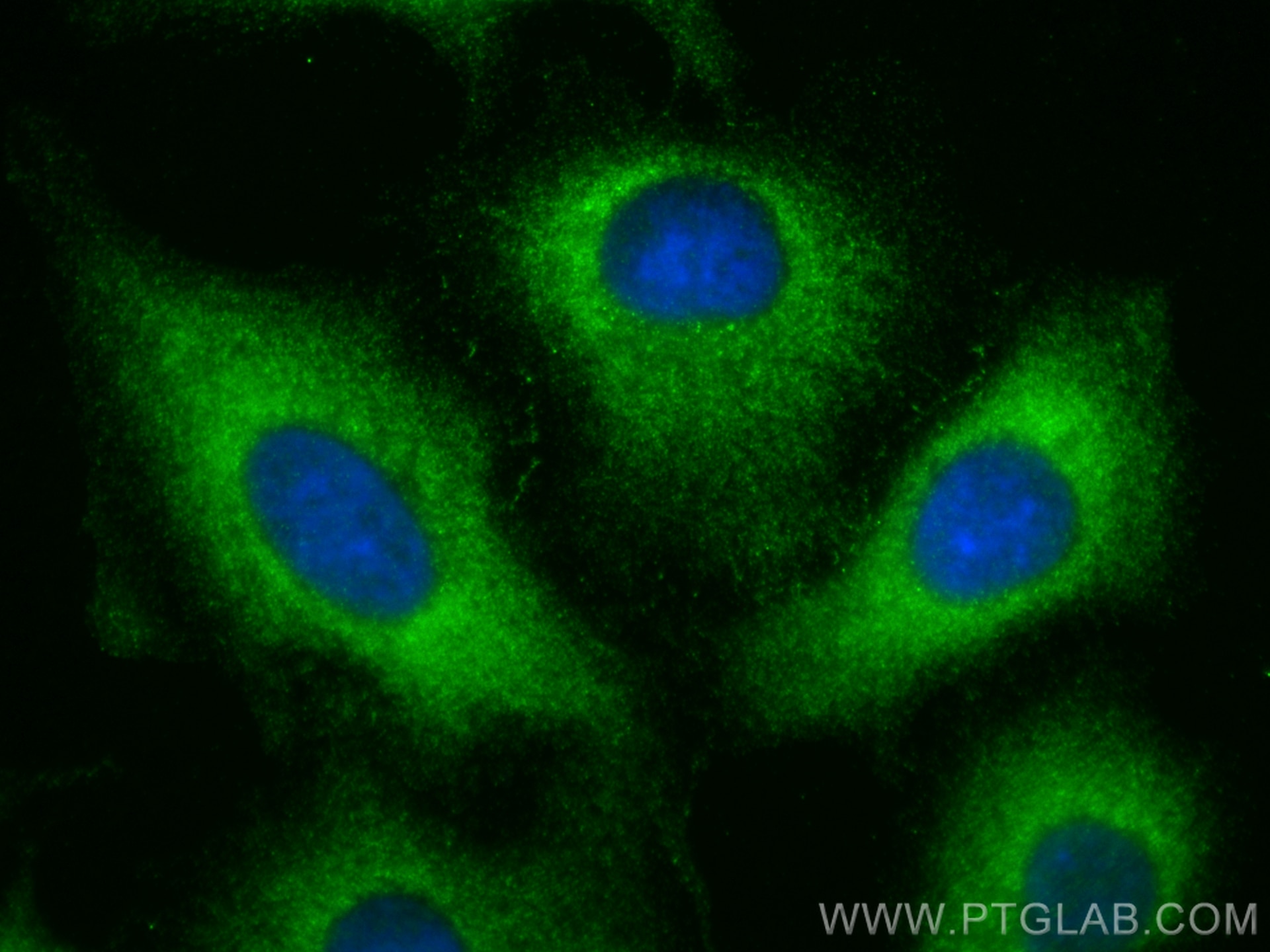 Immunofluorescence (IF) / fluorescent staining of A549 cells using ARHGAP25 Polyclonal antibody (14349-1-AP)
