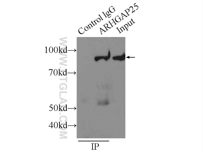 Immunoprecipitation (IP) experiment of Jurkat cells using ARHGAP25 Polyclonal antibody (14349-1-AP)