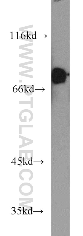 Western Blot (WB) analysis of Jurkat cells using ARHGAP25 Polyclonal antibody (14349-1-AP)