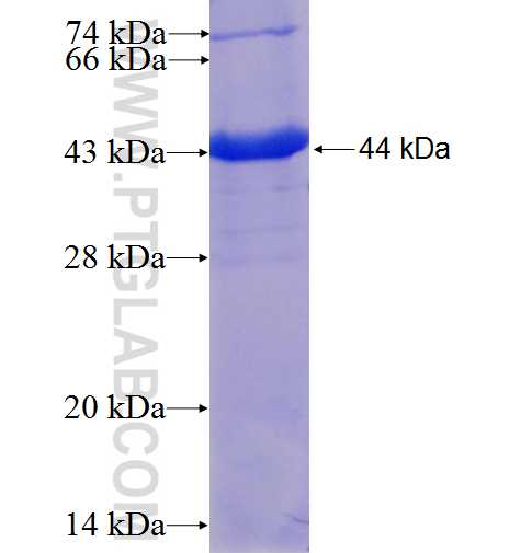 ARHGAP25 fusion protein Ag6178 SDS-PAGE