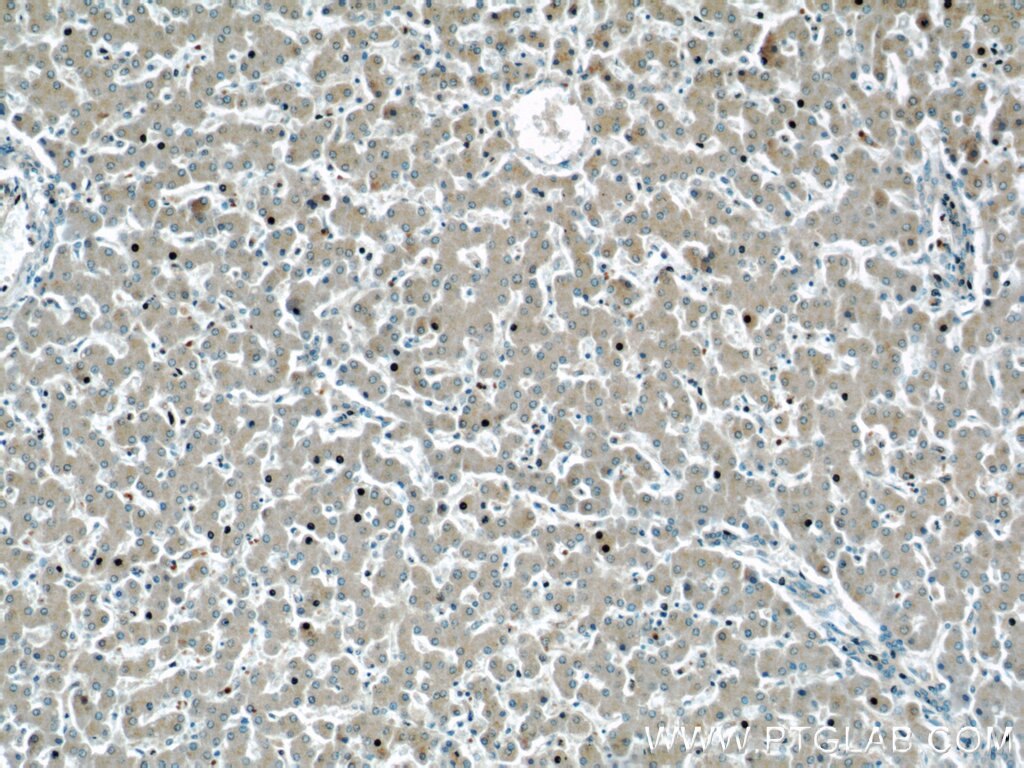 Immunohistochemistry (IHC) staining of human liver tissue using GRAF Polyclonal antibody (17747-1-AP)