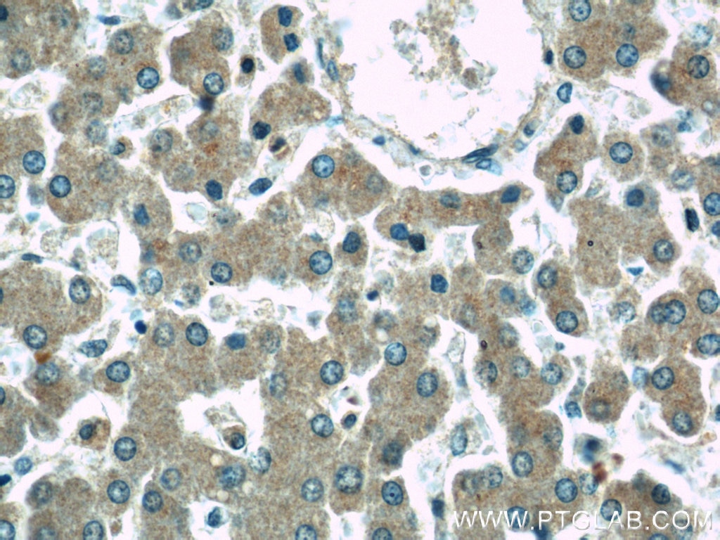 Immunohistochemistry (IHC) staining of human liver tissue using GRAF Polyclonal antibody (17747-1-AP)