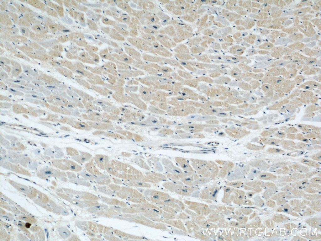 IHC staining of human heart using 17747-1-AP