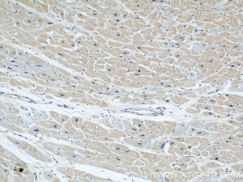 Immunohistochemistry (IHC) staining of human heart tissue using GRAF Polyclonal antibody (17747-1-AP)