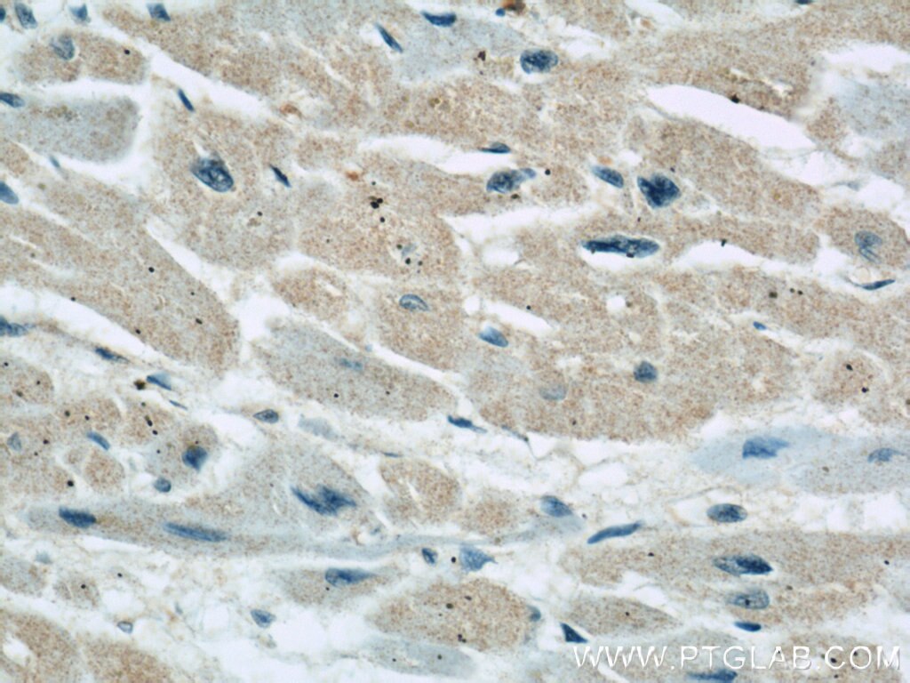 Immunohistochemistry (IHC) staining of human heart tissue using GRAF Polyclonal antibody (17747-1-AP)