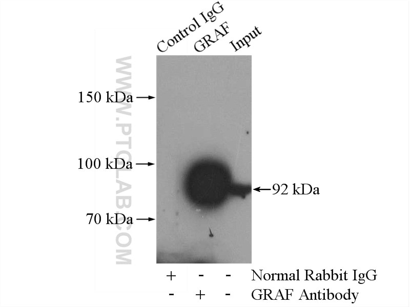 Immunoprecipitation (IP) experiment of HepG2 cells using GRAF Polyclonal antibody (17747-1-AP)