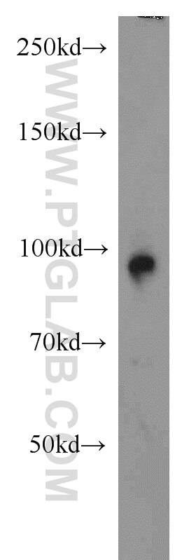 Western Blot (WB) analysis of human brain tissue using GRAF Polyclonal antibody (17747-1-AP)