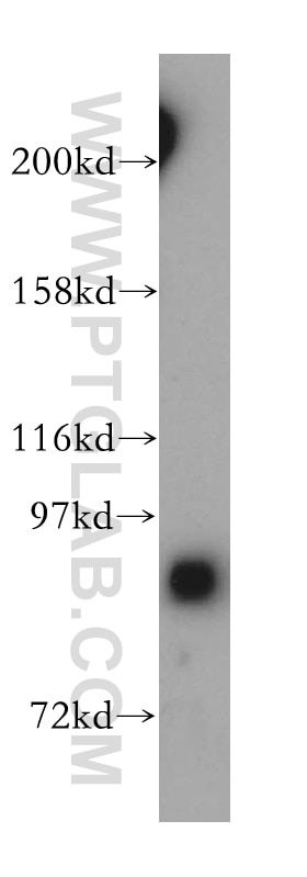 Western Blot (WB) analysis of HeLa cells using GRAF Polyclonal antibody (17747-1-AP)