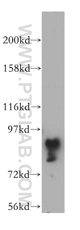 Western Blot (WB) analysis of mouse thymus tissue using GRAF Polyclonal antibody (17747-1-AP)
