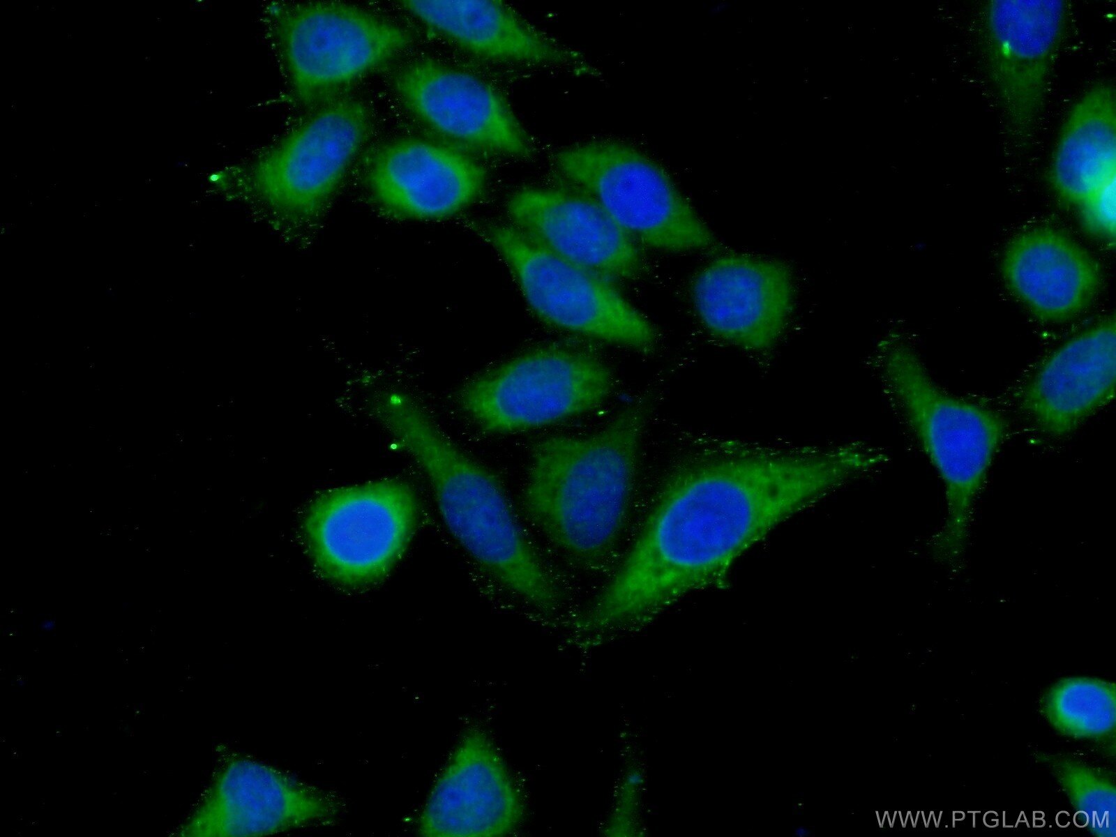 Immunofluorescence (IF) / fluorescent staining of HeLa cells using ARHGAP27 Polyclonal antibody (22077-1-AP)