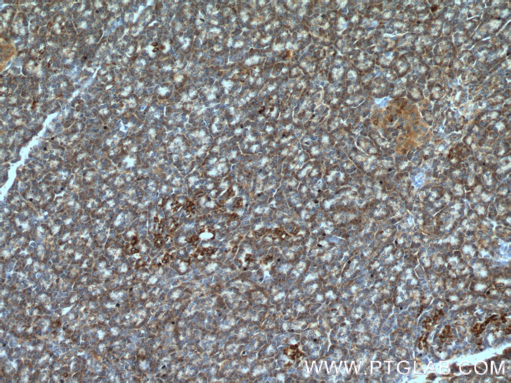Immunohistochemistry (IHC) staining of human pancreas tissue using ARHGAP27 Polyclonal antibody (22077-1-AP)
