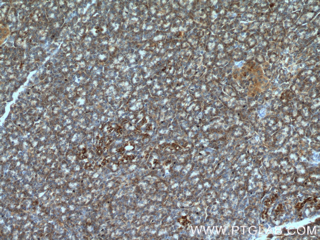 Immunohistochemistry (IHC) staining of human pancreas tissue using ARHGAP27 Polyclonal antibody (22077-1-AP)