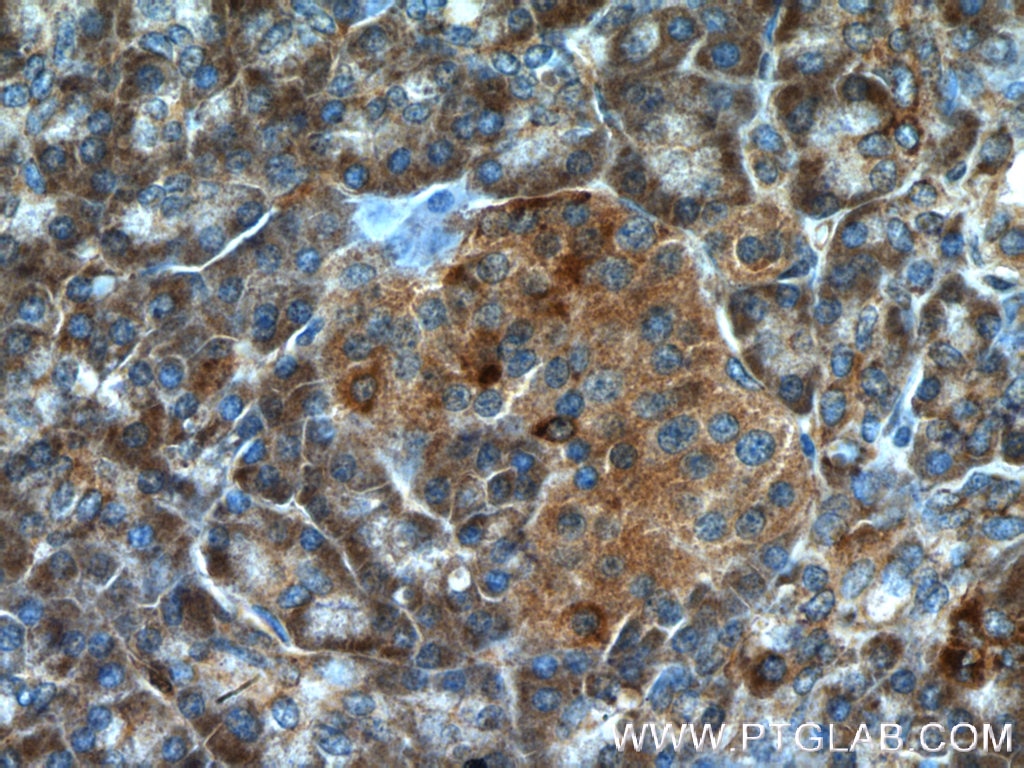 Immunohistochemistry (IHC) staining of human pancreas tissue using ARHGAP27 Polyclonal antibody (22077-1-AP)