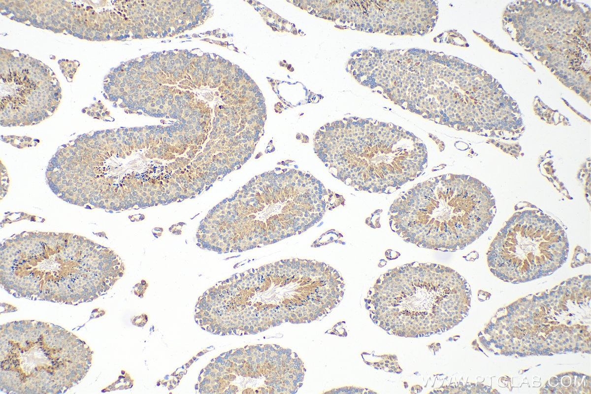 Immunohistochemistry (IHC) staining of mouse testis tissue using ARHGAP28 Polyclonal antibody (26766-1-AP)
