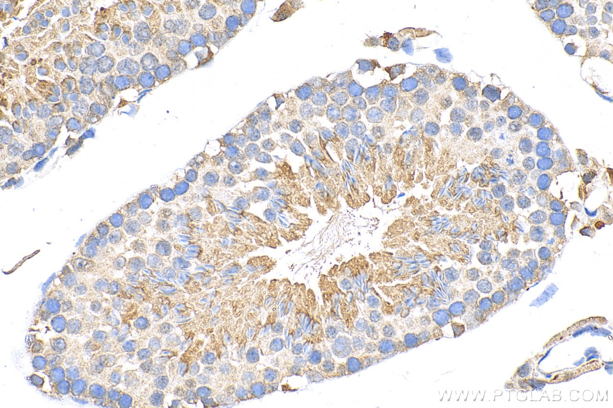Immunohistochemistry (IHC) staining of mouse testis tissue using ARHGAP28 Polyclonal antibody (26766-1-AP)