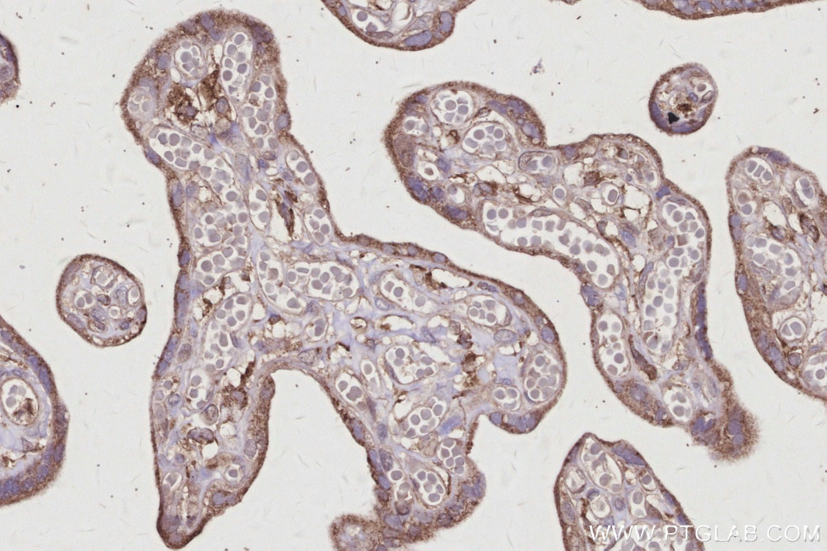 IHC staining of human placenta using 26766-1-AP Immunohistochemistry (IHC) staining of human placenta tissue using ARHGAP28 Polyclonal antibody (26766-1-AP)