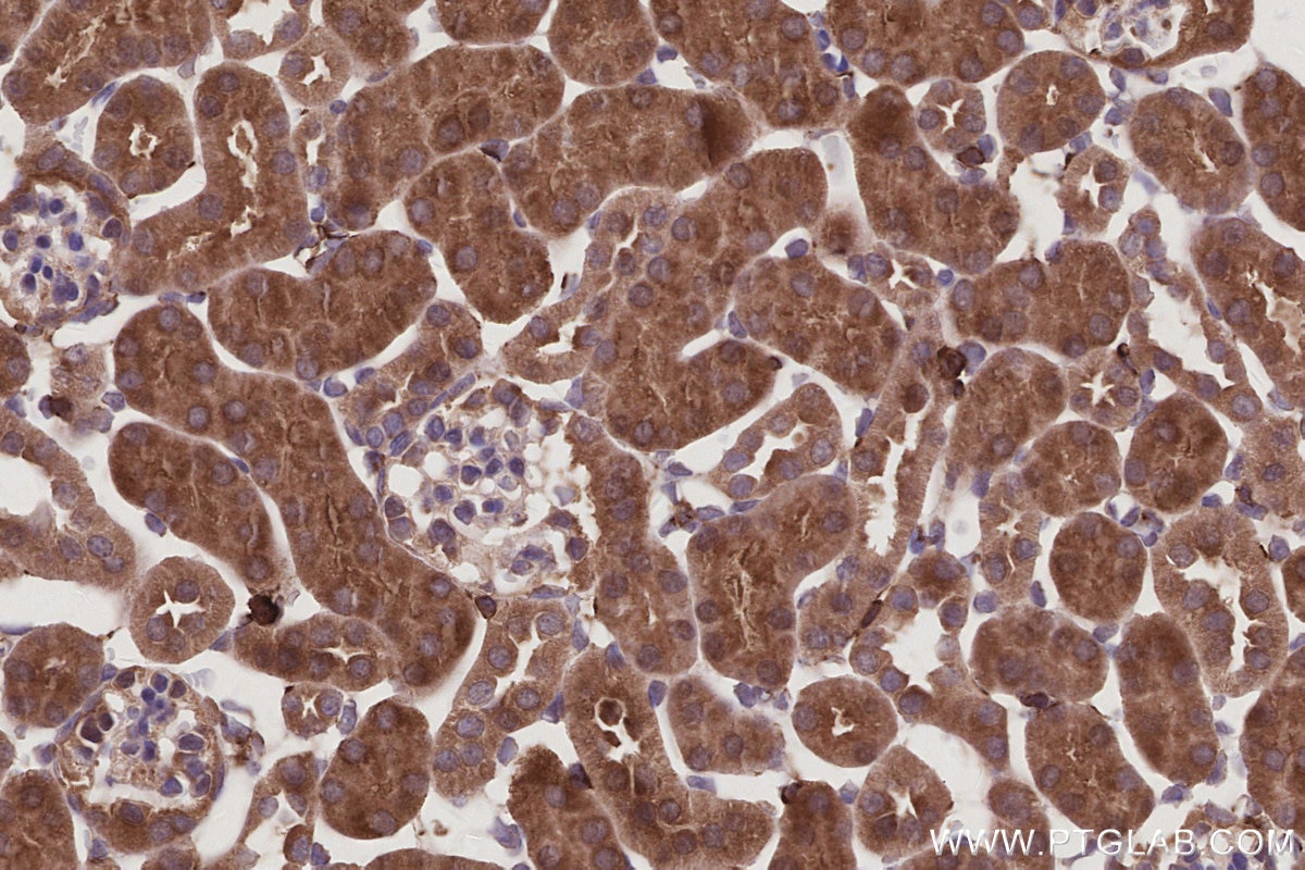 IHC staining of mouse kidney using 26766-1-AP Immunohistochemistry (IHC) staining of mouse kidney tissue using ARHGAP28 Polyclonal antibody (26766-1-AP)