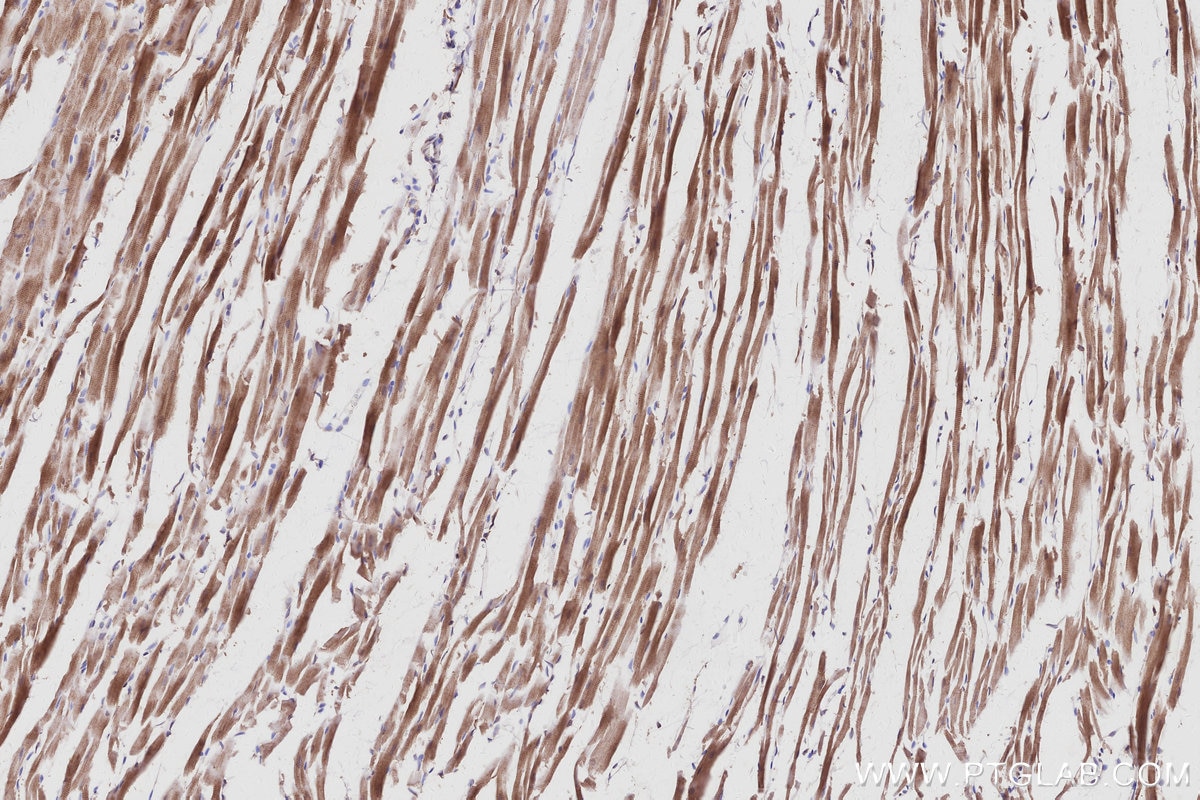 IHC staining of rat heart using 26766-1-AP Immunohistochemistry (IHC) staining of rat heart tissue using ARHGAP28 Polyclonal antibody (26766-1-AP)