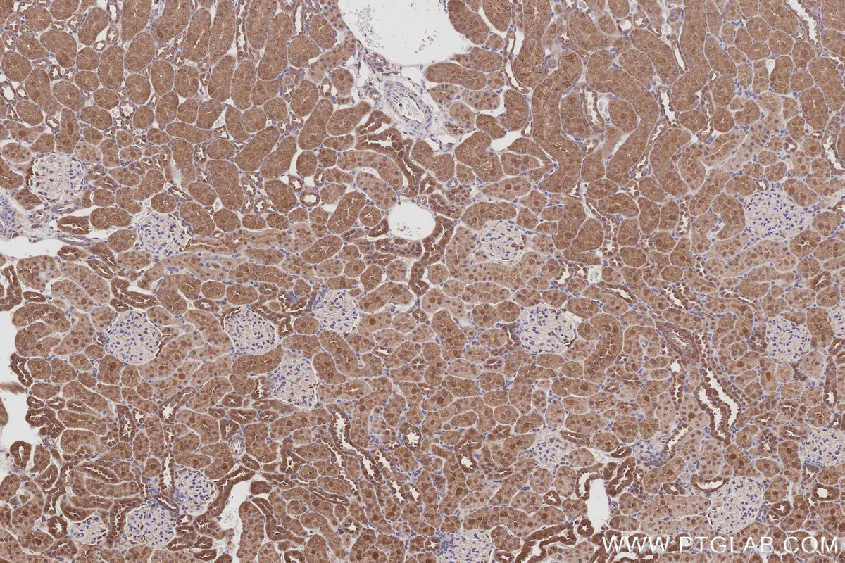 IHC staining of rat kidney using 26766-1-AP Immunohistochemistry (IHC) staining of rat kidney tissue using ARHGAP28 Polyclonal antibody (26766-1-AP)