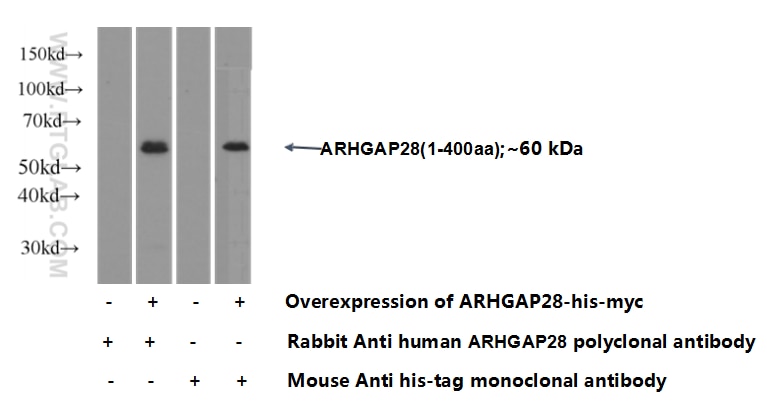 ARHGAP28