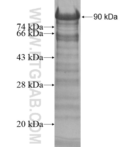 ARHGAP30 fusion protein Ag11992 SDS-PAGE