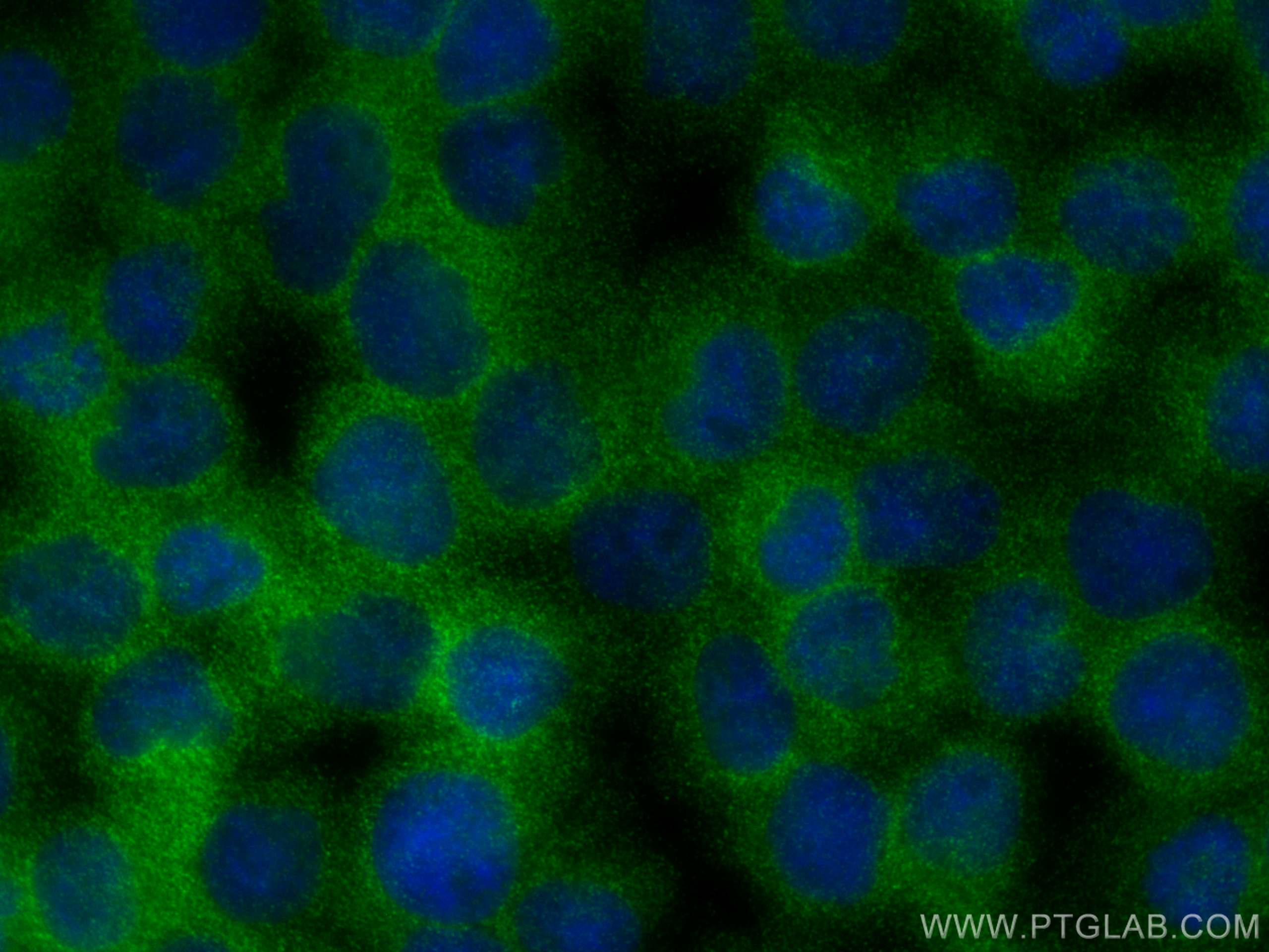 Immunofluorescence (IF) / fluorescent staining of Jurkat cells using ARHGAP4 Polyclonal antibody (16697-1-AP)