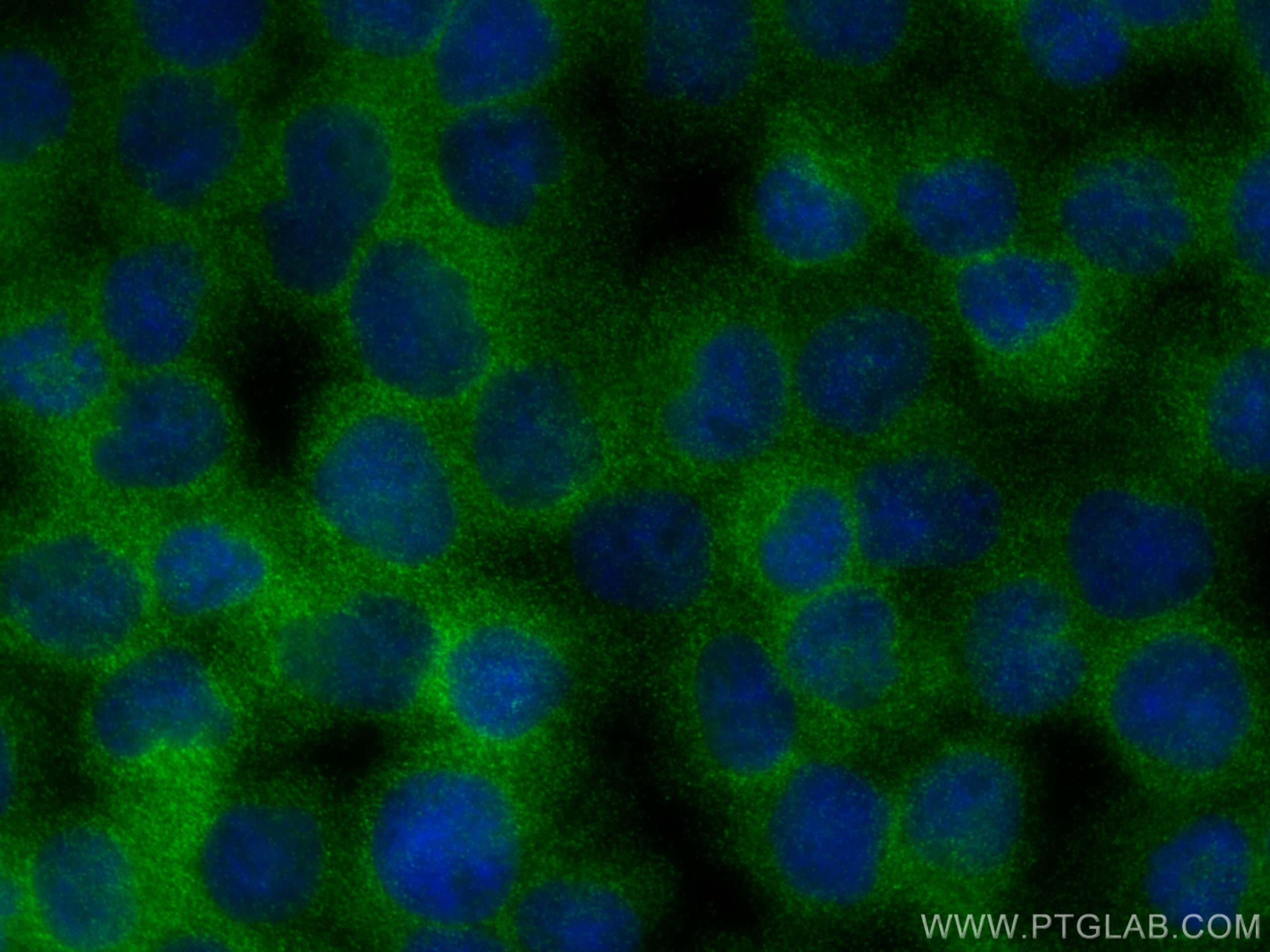 IF Staining of Jurkat using 16697-1-AP