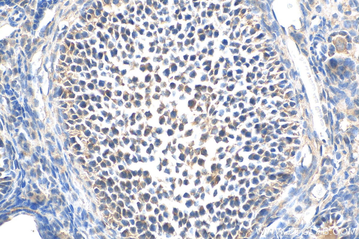 Immunohistochemistry (IHC) staining of mouse ovary tissue using ARHGAP4 Polyclonal antibody (16697-1-AP)