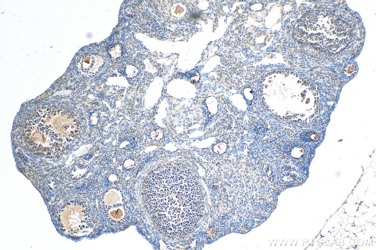 Immunohistochemistry (IHC) staining of mouse ovary tissue using ARHGAP4 Polyclonal antibody (16697-1-AP)