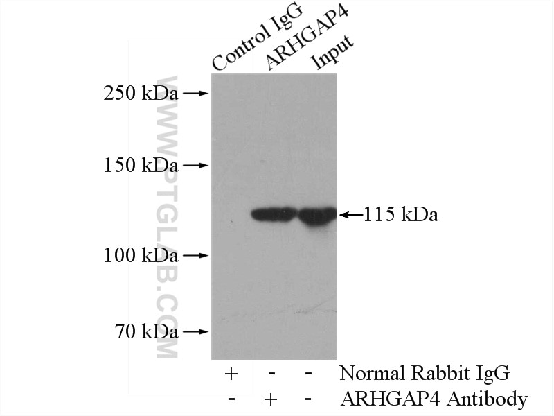 Immunoprecipitation (IP) experiment of HL-60 cells using ARHGAP4 Polyclonal antibody (16697-1-AP)