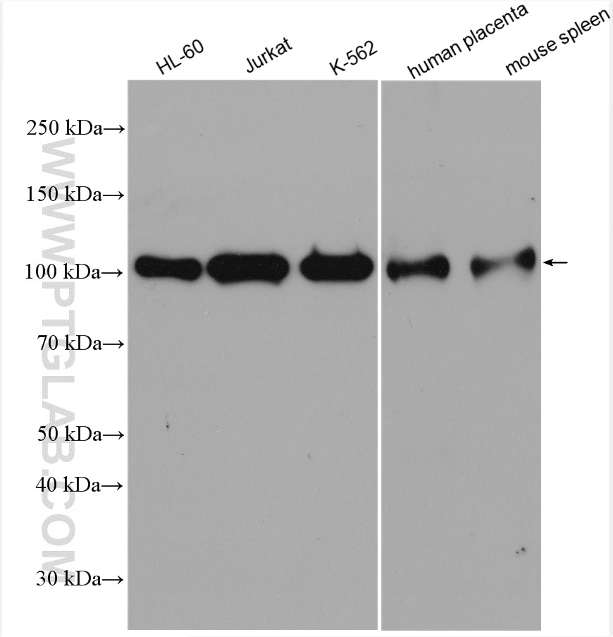 Western Blot (WB) analysis of various lysates using ARHGAP4 Polyclonal antibody (16697-1-AP)