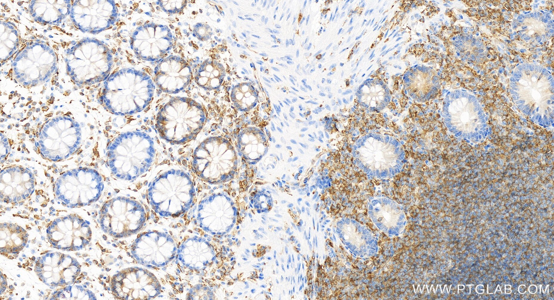 Immunohistochemistry (IHC) staining of human colon tissue using ARHGAP4 Recombinant antibody (85648-2-RR)