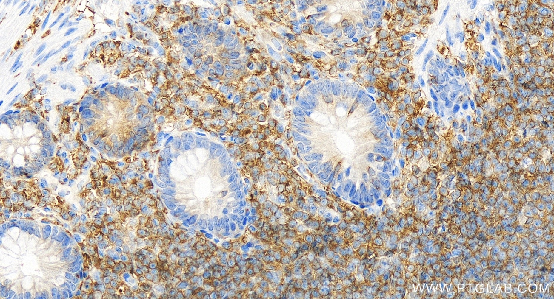 Immunohistochemistry (IHC) staining of human colon tissue using ARHGAP4 Recombinant antibody (85648-2-RR)