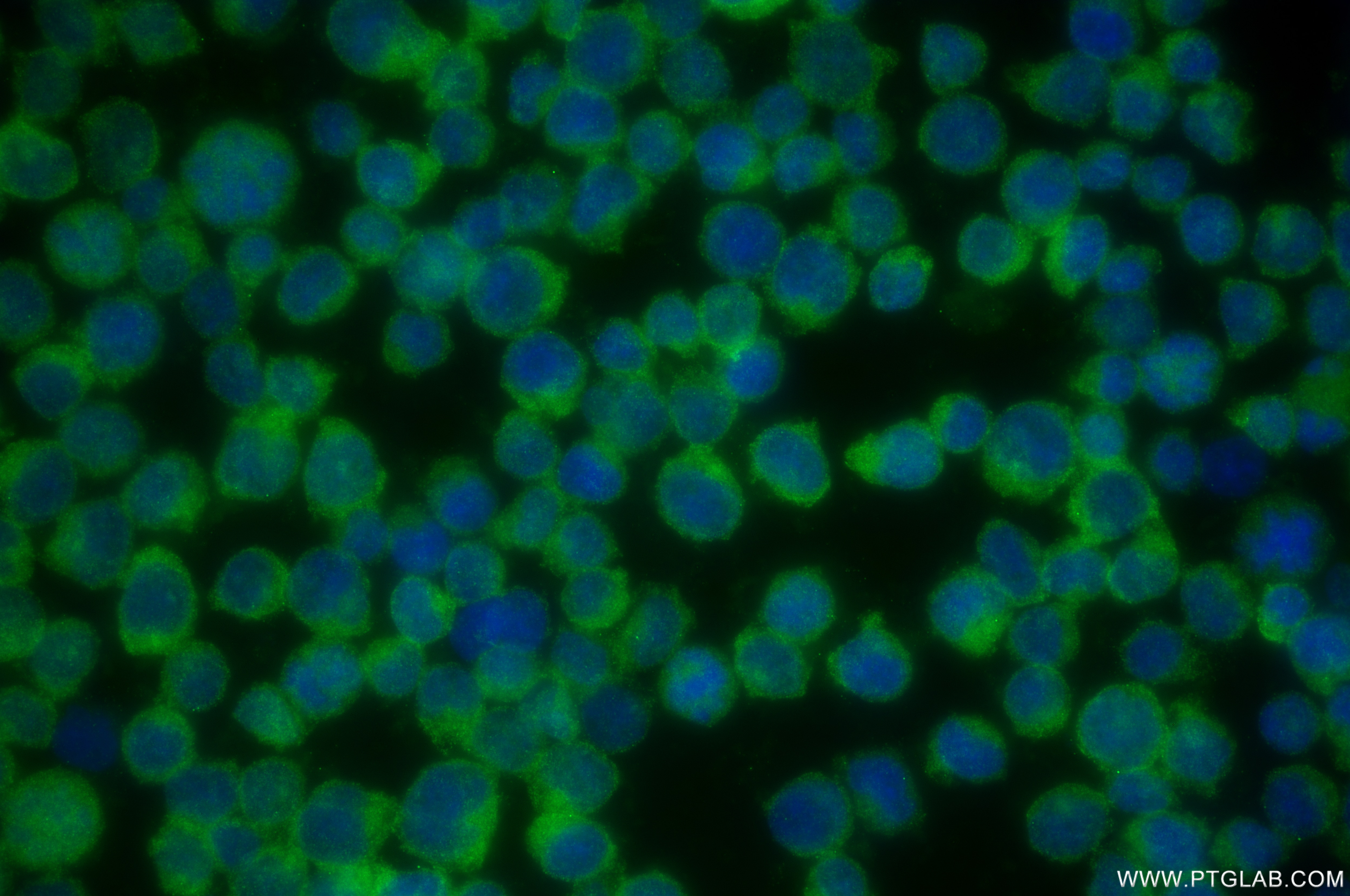 Immunofluorescence (IF) / fluorescent staining of Jurkat cells using ARHGAP4 Recombinant antibody (85648-2-RR)