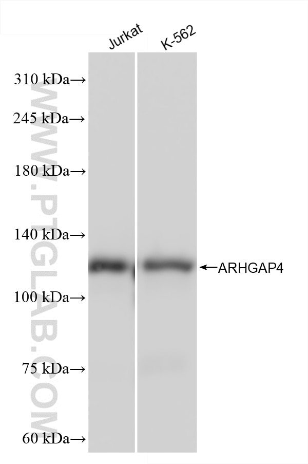 Western Blot (WB) analysis of various lysates using ARHGAP4 Recombinant antibody (85648-2-RR)