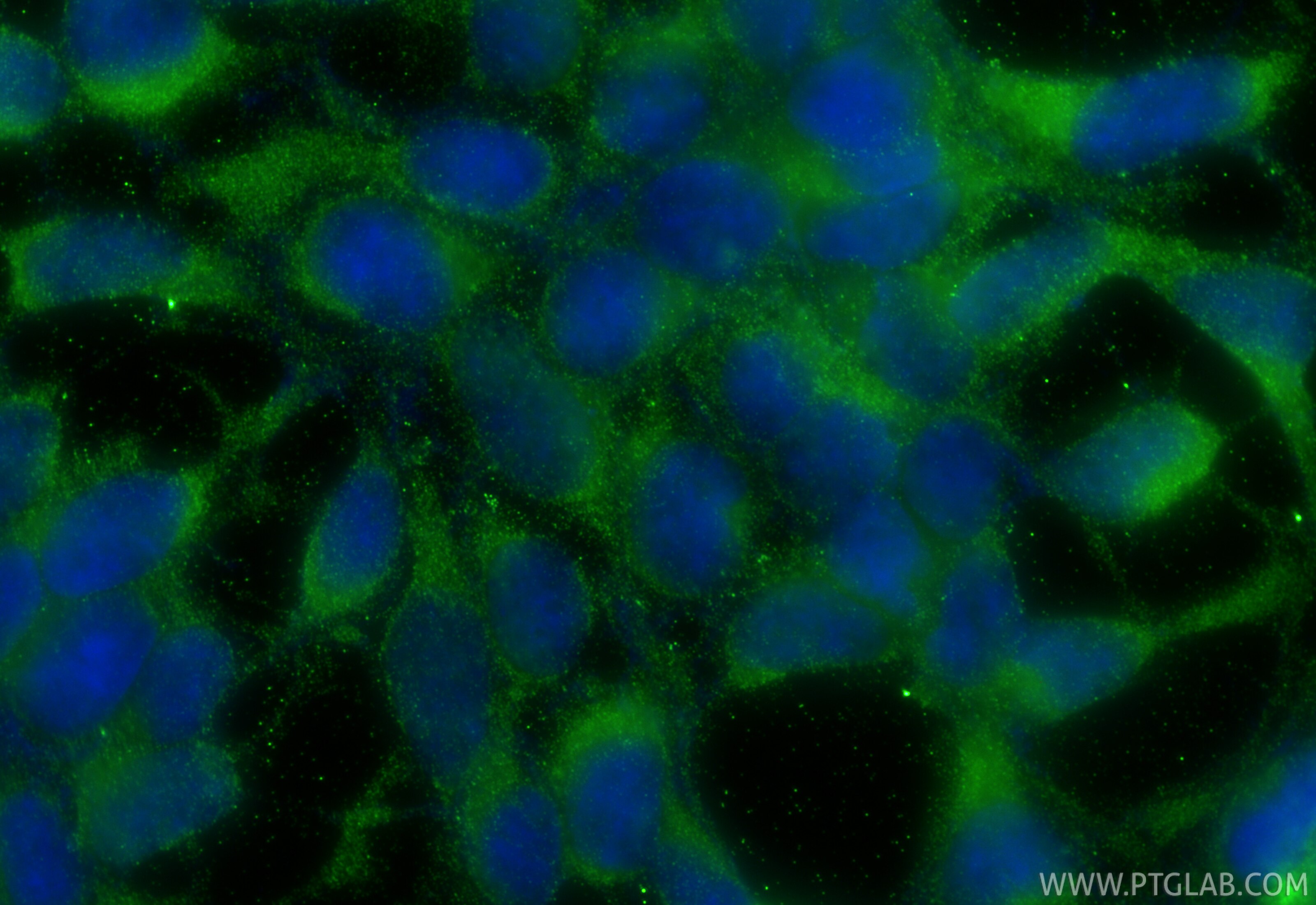 Immunofluorescence (IF) / fluorescent staining of HEK-293 cells using ARHGAP44 Polyclonal antibody (32382-1-AP)