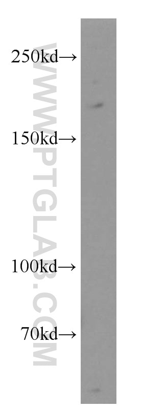 Western Blot (WB) analysis of Jurkat cells using ARHGAP5 Polyclonal antibody (55165-1-AP)