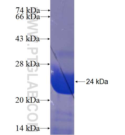 ARHGAP6 fusion protein Ag23152 SDS-PAGE