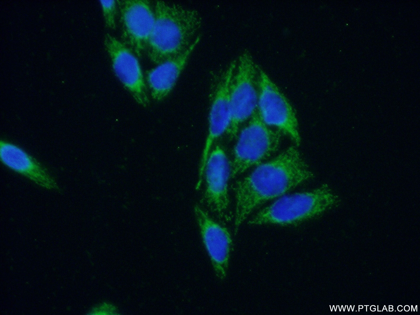 Immunofluorescence (IF) / fluorescent staining of HeLa cells using ARHGAP9 Polyclonal antibody (15665-1-AP)