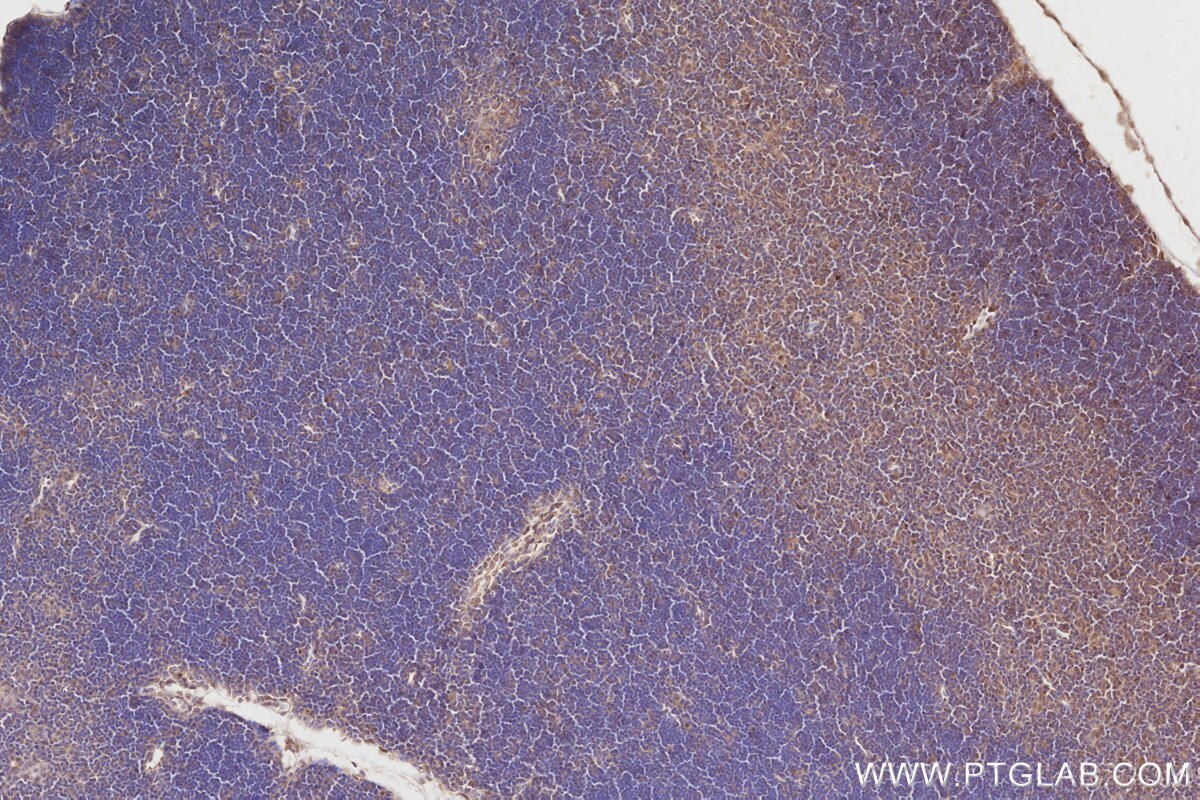 Immunohistochemistry (IHC) staining of mouse thymus tissue using ARHGAP9 Polyclonal antibody (15665-1-AP)