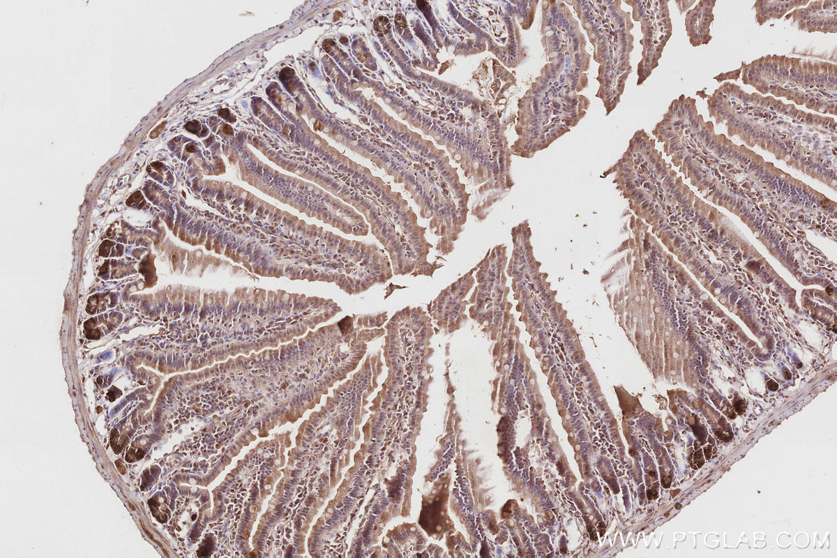 Immunohistochemistry (IHC) staining of mouse small intestine tissue using ARHGAP9 Polyclonal antibody (15665-1-AP)
